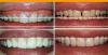 Photo of Chisel Dental Clinic Ulsoor Bangalore