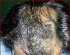 Photo of Orange Tree Aesthetic and Hair Restoration Vasant Vihar Delhi