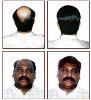 Photo of Fair & Hair Adyar Chennai