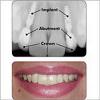 Photo of Dr. Aggarwal's Advance Dental & Root Canal Treatment Centre Safdarjung Enclave Delhi