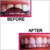 Photo of Dr. Aggarwal's Advance Dental & Root Canal Treatment Centre Safdarjung Enclave Delhi